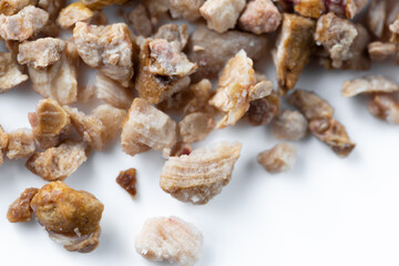 Kidney stones. Stones were removed from the patient's kidneys