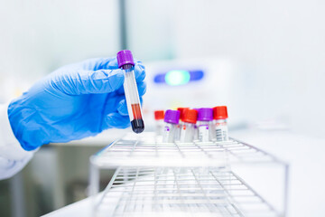 Hand of scientist or laboratory technician with blue medical glove inside lab room in hospital or...