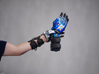 Bionic Hand Prosthesis Holding a Hand