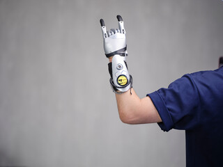 Bionic Hand Prosthesis