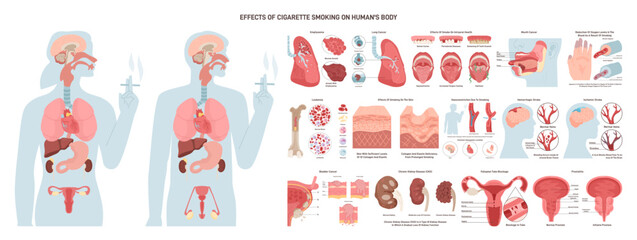 Diagram about health effect of cigarette smoking. Illustration about risk of smokers.