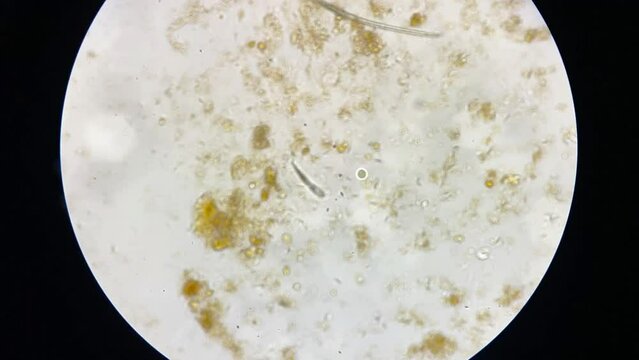 Demodex mange from a microscope view.