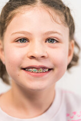 Little girl with rainbow braces