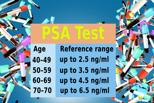 PSA test infographic. Table of indicators by age. PSA analysis average data. Infographics for diagnosing serology. Test tubes with blood. PSA test for patients. Cancer symptoms. 3d image