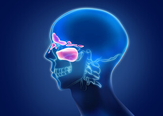 X-ray picture of man showing progressing sinusitis in nasal cavities on blue background, illustration - obrazy, fototapety, plakaty