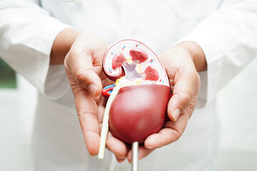 Chronic kidney disease, doctor holding model for treatment urinary system, urology, Estimated...