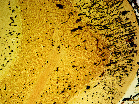 Delicate Complexity: Golgi Stained Cerebellum Layers at 100x