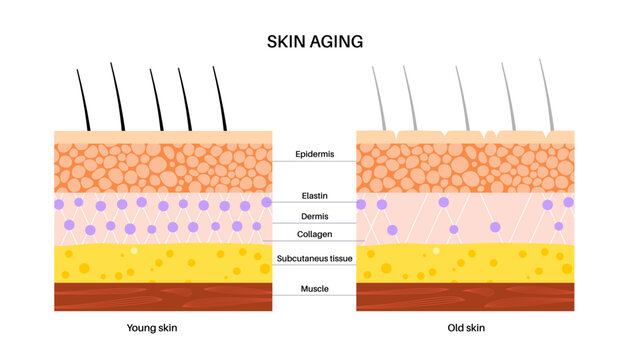 Skin aging poster