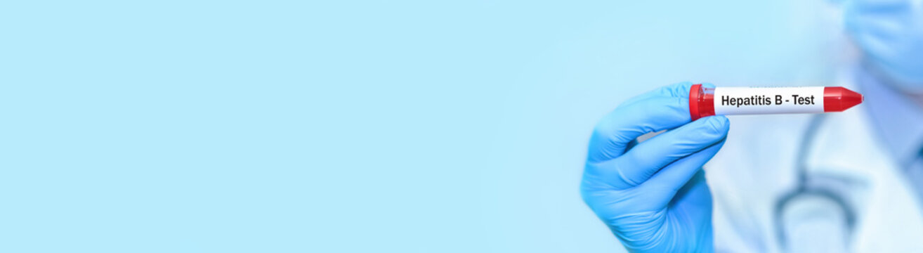 Doctor holding a test blood sample tube with hepatitis B virus (HBV) test.Banner. Copy space for text
