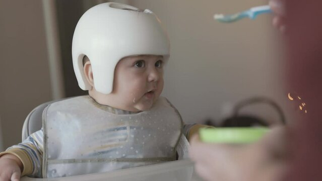 8 Month Old Baby Wearing Therapy Helmet In High Chair Being Fed and Excited for More. slow motion of an 8 month old in a high chair wearing a corrective therapy helmet and being fed then excited
