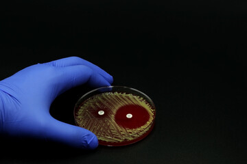 Hand of scientist or doctor showing a microbiological culture Petri dish with bacteria where an...