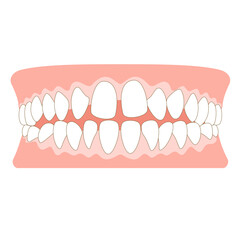 すきっ歯の歯並び