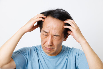 脱毛の問題を抱える成熟した日本人