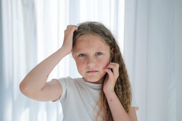 The child scratches his head with a rash. Itching from chickenpox in a girl.