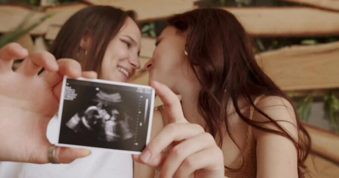 Lesbians waiting for baby Embracing, looking and show the ultrasound picture. Embrace and holding each other. Love LGBTQI. LGBT rights, Women Lgbt Couple rest at home. Lesbian family.
