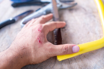 Craftsman's hand with bleeding wound, Tool accident while working, insurance, accident, risky occupation, risk