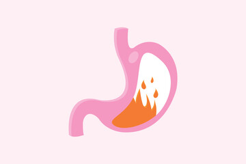 medical illustration of pyrosis stomach isolated. Fire disorder inside stomach.