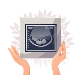 Ultrasonography picture, fetus ultrasound, vector
