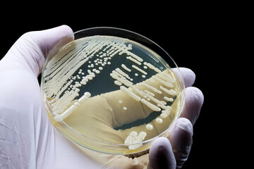 Hand of doctor or scientist showing a microbiological culture of the yeast Candida auris,...