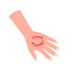 Obraz premium Dog bite mark on hand in flat design on white background.