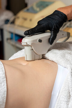 young woman on a stretcher performing an aesthetic treatment on the skin and face with the hifu technique performed by a beautician for body and health care