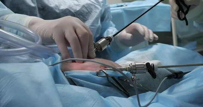 An assistant helps a veterinary surgeon on a laparoscopic operation. Laparoscopic sterilization of a dog under anesthesia. A professional endoscopist performs precise surgery on a pet.