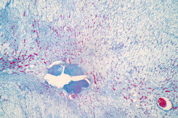 Showing Light micrograph of the Adrenal gland and Urinary bladder human under the microscope for...