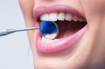 Teeth mirror close-up. Examination of teeth with dental mirror. Tooth filling. Teeth examined at...