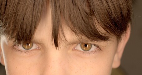 He blinks frequently, tired eyes freckles on the skin Brown hair, brown eyes man. Close-up of a teenager boy blinking eyes. 