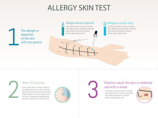 Allergy skin test: drop or intradermal test and process.
