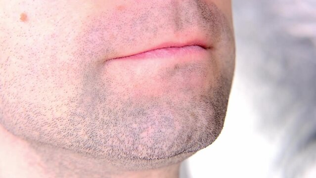 close-up of patient, young man with open mouth, dentist, doctor examines oral cavity, regular preventive examination, dentistry, dental treatment, dental prosthetics, caries prevention