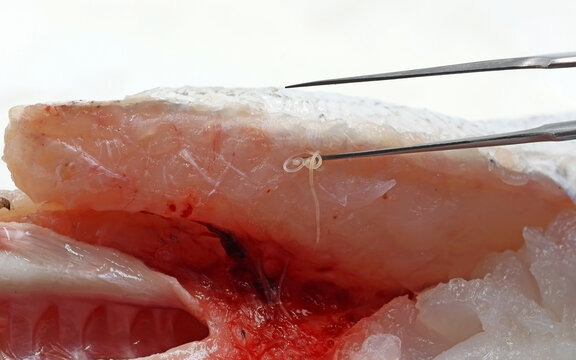 Extraction of parasitic worms Anisakis from a fish