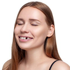 Obraz premium Woman teeth with hole. Dental implant concept.