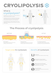 Cryolipolysis vector infographic.
Graphics of the treatment with tissues, skin layers and reduction of fat cells. Body fat problems areas pictogram and weight loss icon. Fat freezing benefits icon set