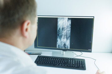 doctor studying x-ray on computer