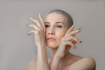 Portrait of an emotional young beautiful woman with a shaved head close-up. The result of chemotherapy in the treatment of breast cancer