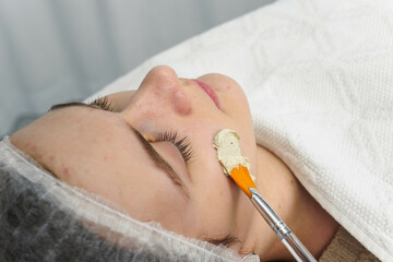 cosmetologist-dermatologist applies a facial gel peeling mask to the woman face. professional procedure in a beauty clinic salon for client. Skincare and cosmetology spa concept