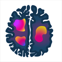 MRI brain scan icon. Medical imaging technology for mental health assessment and abnormality diagnostics. Activity visualization. Vector illustration isolated on white.