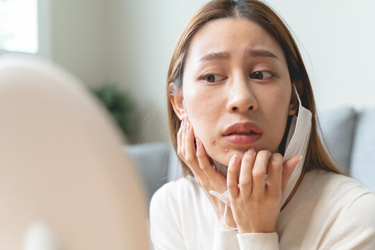 Asian Young Woman Worry About Acne On Her Face After Wear Face Mask.