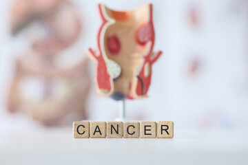 Word Cancer against realistic model of sick human rectum