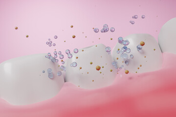 Tooth and gums with tartar or particle of food remove concept. 3D rendering.