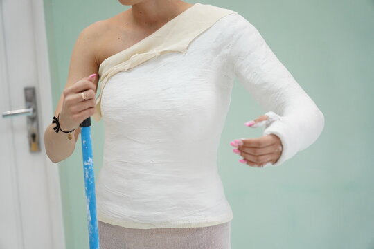 Shoulder Spica Orthopedic Plaster Cast Broken Arm