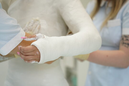 Shoulder Spica Orthopedic Plaster Cast Broken Arm