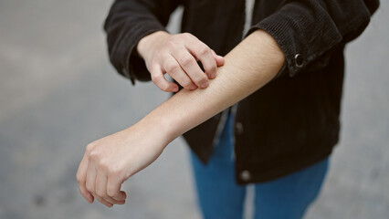 Young beautiful hispanic woman scratching arm for itchy at street