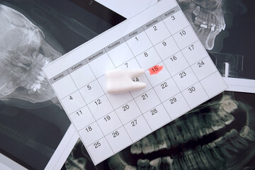 Panoramic snapshot of the jaw the patient's tooth.