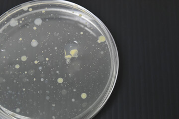 Colonies of bacteria growth on agar plate medium in laboratory.