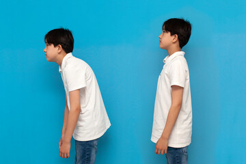 concept of bad posture, boy of twelve years old stoop on blue isolated background - obrazy, fototapety, plakaty