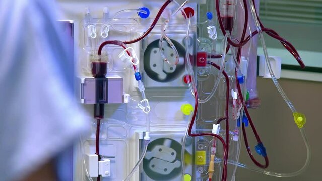 Dialysis Machine in the hospital