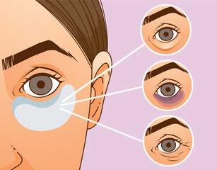 The woman with the skin problems. Wrinkles, dark circles. Under-eyes area. Under-eyes patches. Skin care, cosmetology procedure. Healthcare Illustration. Vector illustration.