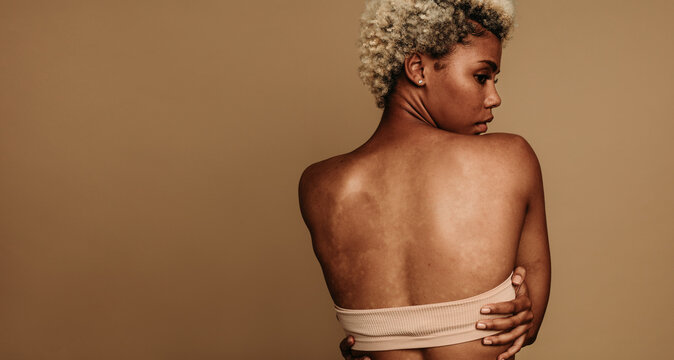 Confident Gen Z woman embracing her unique skin tone